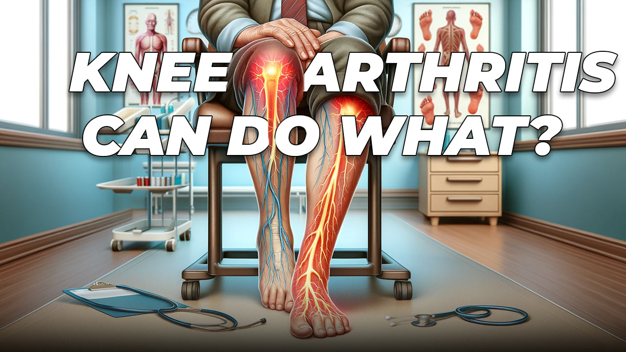 Can Knee Arthritis Cause Calf Pain?