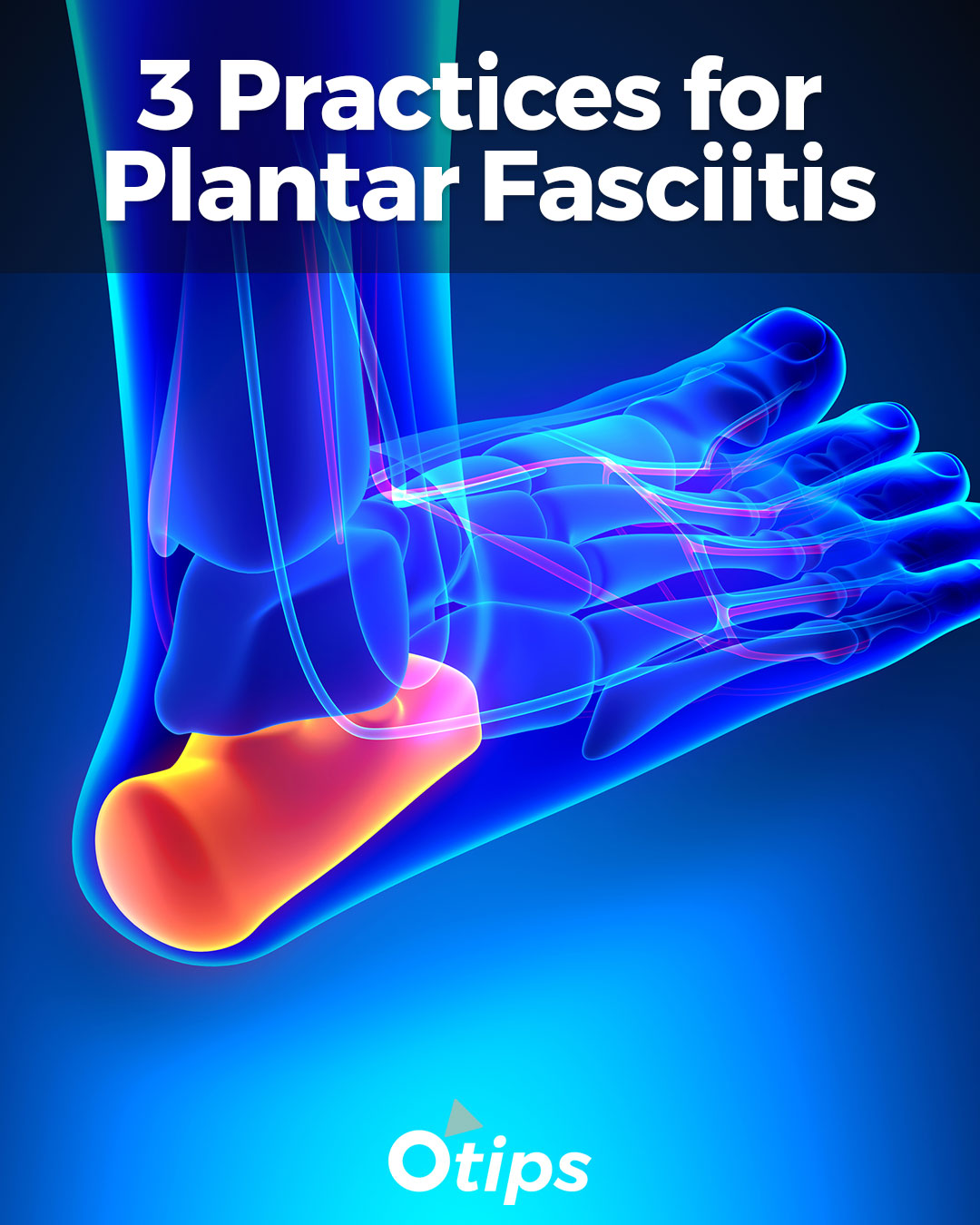3 Tips for Plantar Fasciitis
