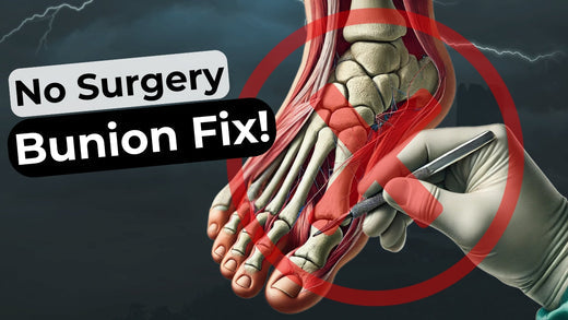 Can Bunions Be Corrected Without Surgery? (5 Research-Backed Methods for Pain Relief)